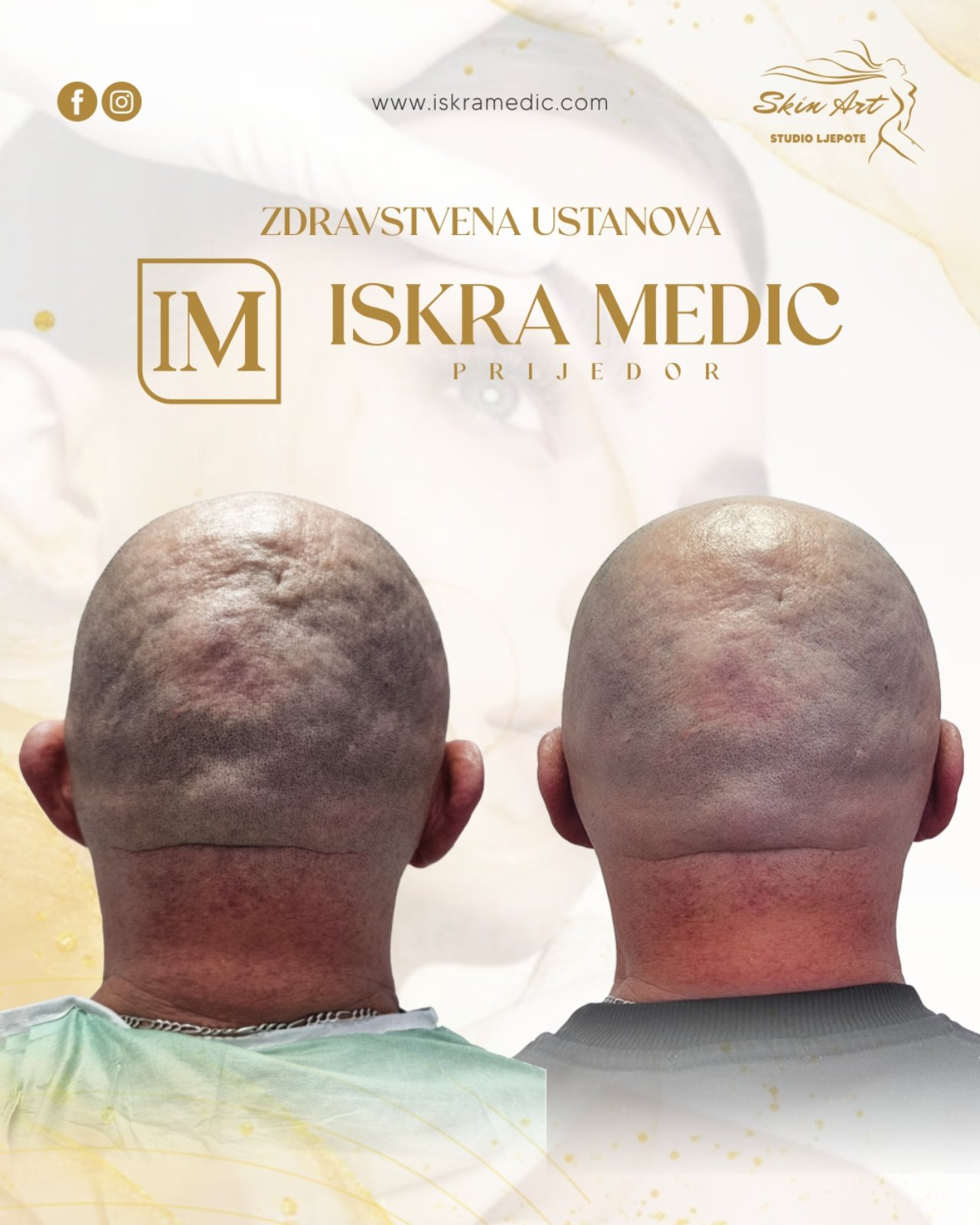 Rezultati hidratacije usana